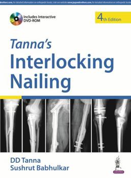 Paperback Tanna'S Interlocking Nailing With Dvd-Rom Book