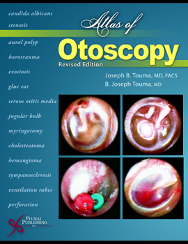 Hardcover Atlas of Otoscopy: Book