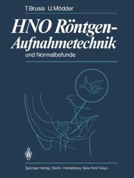 Paperback Hno Röntgen-Aufnahmetechnik Und Normalbefunde [German] Book