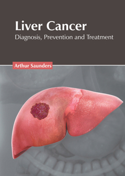 Hardcover Liver Cancer: Diagnosis, Prevention and Treatment Book