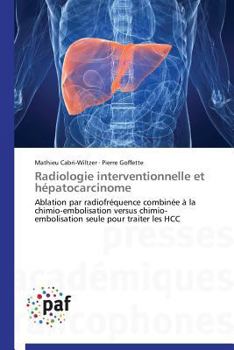 Paperback Radiologie Interventionnelle Et Hépatocarcinome [French] Book
