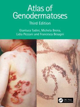 Paperback Atlas of Genodermatoses Book