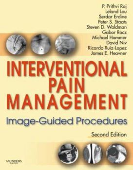 Hardcover Interventional Pain Management: Image-Guided Procedures with DVD Book