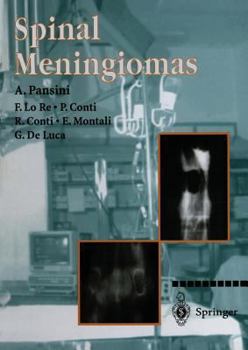 Paperback Spinal Meningiomas Book