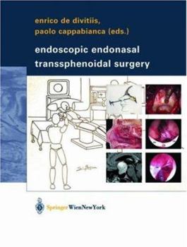 Hardcover Endoscopic Endonasal Transsphenoidal Surgery Book