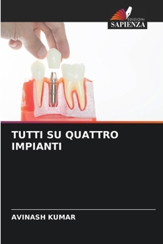 Paperback Tutti Su Quattro Impianti [Italian] Book