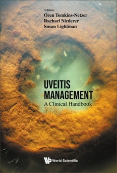 Hardcover Uveitis Management: A Clinical Handbook Book
