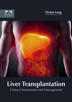 Hardcover Liver Transplantation: Clinical Assessment and Management Book
