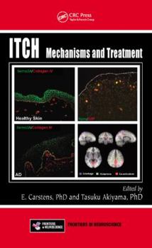 Hardcover Itch: Mechanisms and Treatment Book