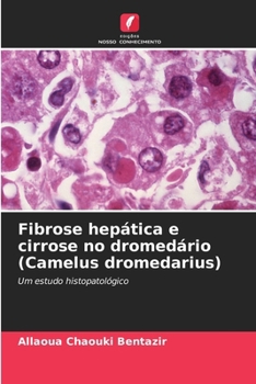 Paperback Fibrose hepática e cirrose no dromedário (Camelus dromedarius) [Portuguese] Book