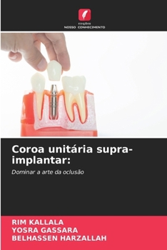 Paperback Coroa unitária supra-implantar [Portuguese] Book