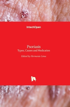 Hardcover Psoriasis: Types, Causes and Medication Book