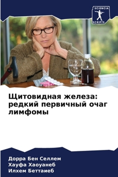 Paperback Щитовидная железа: редки [Russian] Book