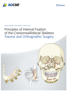 Principles of Internal Fixation of the Craniomaxillofacial Skeleton: Trauma and Orthognathic Surgery