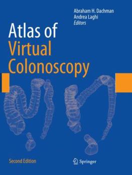 Paperback Atlas of Virtual Colonoscopy Book