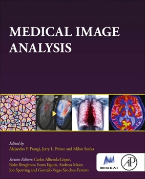Paperback Medical Image Analysis Book