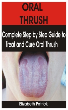 Paperback Oral Thrush: Complete Step by Step Guide to Treat and Cure Oral Thrush Book