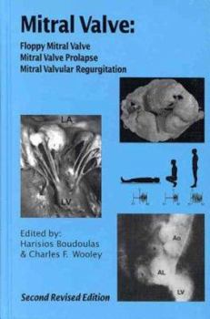 Hardcover Mitral Valve: Flopyy Mitral Valve, Mitral Valve Prolapse, Mitral Valvular Regurgitation Book