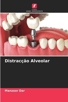Paperback Distracção Alveolar [Portuguese] Book