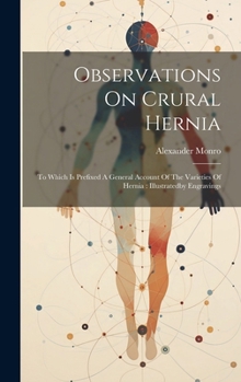 Observations on Crural Hernia: To Which Is Prefixed a General Account of the Varieties of Hernia: Illustratedby Engravings - Primary Source Edition