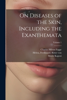 Paperback On Diseases of the Skin, Including the Exanthemata; Volume 1 Book