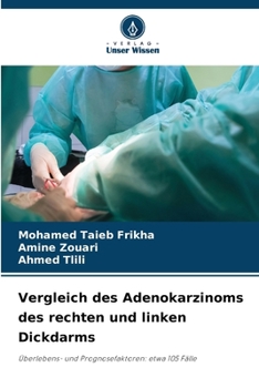 Paperback Vergleich des Adenokarzinoms des rechten und linken Dickdarms [German] Book