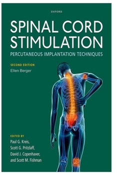 Paperback Spinal Cord Stimulation [Spanish] Book