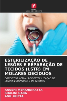 Paperback Esterilização de Lesões E Reparação de Tecidos (Lstr) Em Molares Decíduos [Portuguese] Book