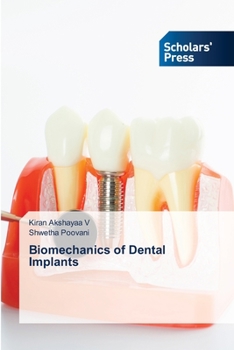 Paperback Biomechanics of Dental Implants Book