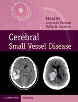Hardcover Cerebral Small Vessel Disease Book