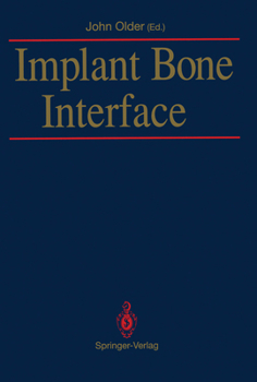 Paperback Implant Bone Interface Book