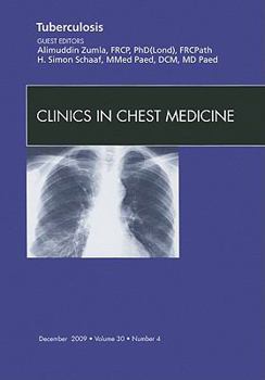 Hardcover Tuberculosis, an Issue of Clinics in Chest Medicine: Volume 30-4 Book