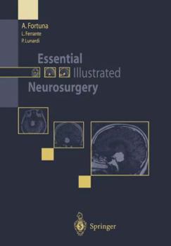 Paperback Essential Illustrated Neurosurgery Book