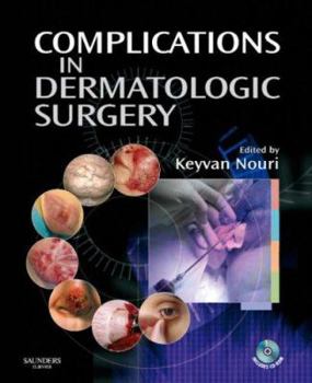Hardcover Complications in Dermatologic Surgery with CDROM Book