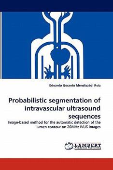 Paperback Probabilistic Segmentation of Intravascular Ultrasound Sequences Book