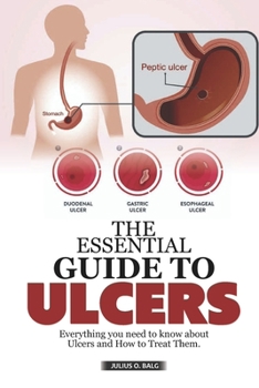 Paperback The Essential Guide to Ulcers: Everything You Nand needs to Know about Ulcers and How to Treat Them Book