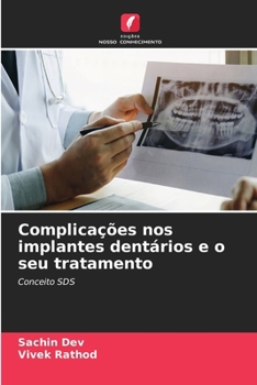 Paperback Complicações nos implantes dentários e o seu tratamento [Portuguese] Book