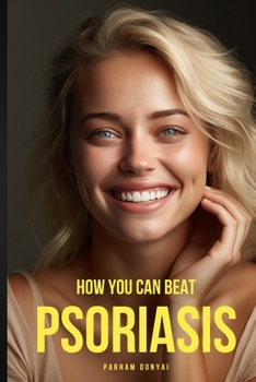 Paperback How You Can Beat Psoriasis: Quick Practical Remedies That Work Book