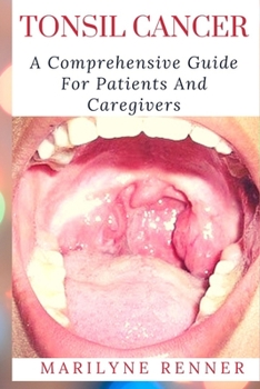 Paperback Tonsil Cancer: A Comprehensive Guide For Patients and Caregivers Book