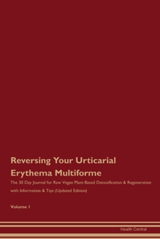 Paperback Reversing Your Urticarial Erythema Multiforme: The 30 Day Journal for Raw Vegan Plant-Based Detoxification & Regeneration with Information & Tips (Upd Book
