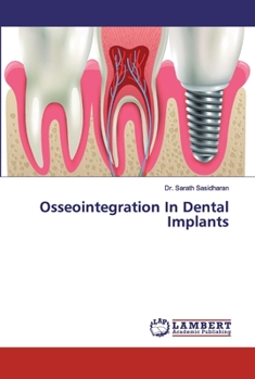Paperback Osseointegration In Dental Implants Book