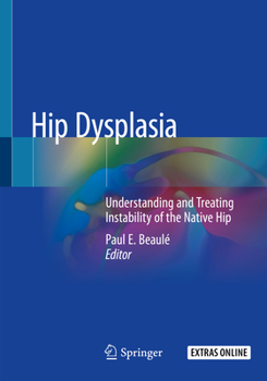 Paperback Hip Dysplasia: Understanding and Treating Instability of the Native Hip Book