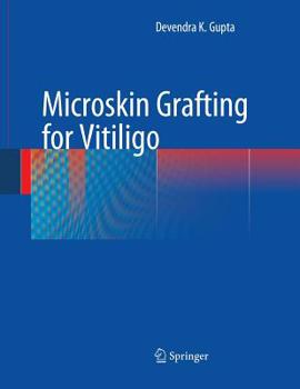 Paperback Microskin Grafting for Vitiligo Book