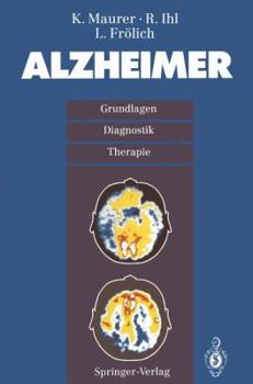 Paperback Alzheimer: Grundlagen, Diganostik, Therapie [German] Book