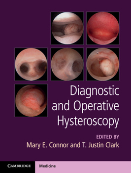 Hardcover Diagnostic and Operative Hysteroscopy Book
