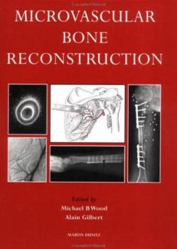 Paperback Microvascular Bone Reconstruction Book
