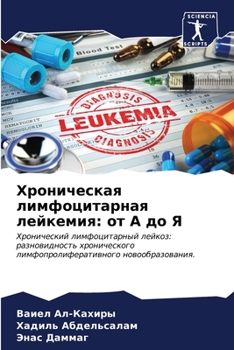 Paperback Хроническая лимфоцитар&# [Russian] Book