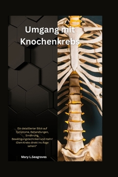 Umgang mit Knochenkrebs: Ein detaillierter Blick auf Symptome, Behandlungen, Ernährung, Bewältigungstechniken und mehr! (Dem Krebs direkt ins Auge sehen)“ (German Edition)