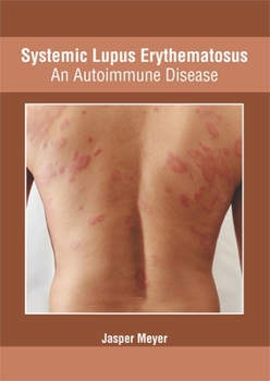 Hardcover Systemic Lupus Erythematosus: An Autoimmune Disease Book