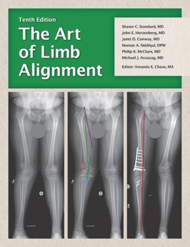 Paperback The Art of Limb Alignment, Tenth Edition Book